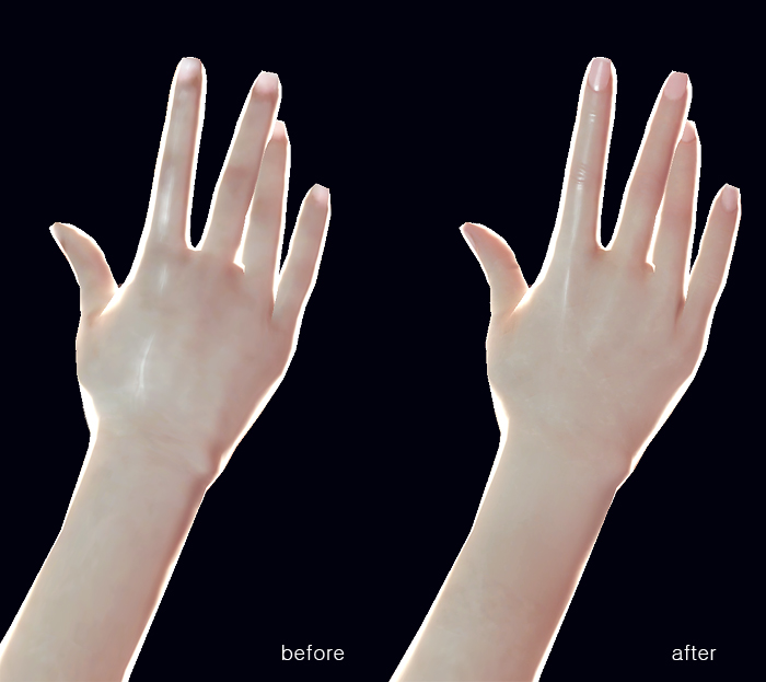여성 손등의 개선 모습 비교