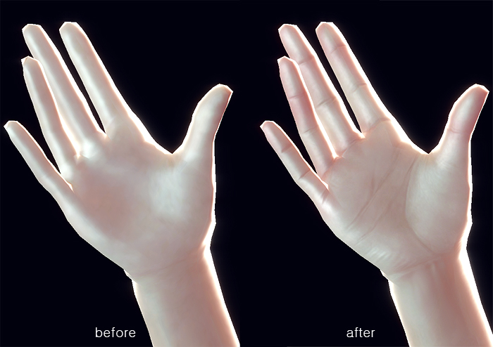 여성 손 바닥의 개선 모습 비교